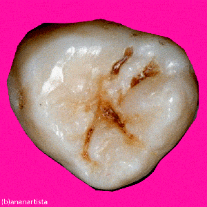 il suicidio, aforismi e citazioni del filosofo emil cioran per vivere meglio con animazioni gif del pittore patafisico (b)ananartista